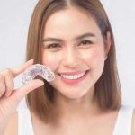 Najbolj priljubljena vrsta aparata za zobe Najbolj priljubljena vrsta aparata za zobe